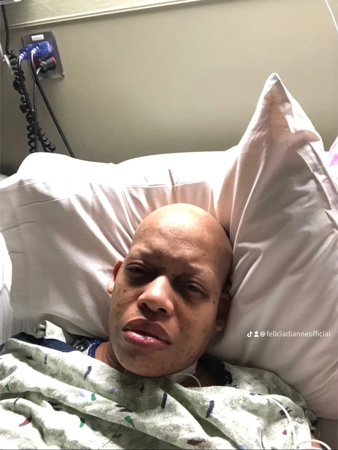 Felicia during treatment in the hospital